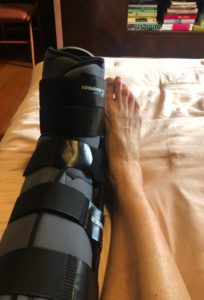 Cirurgia do tendão de Aquiles, vulnerabilidade e força